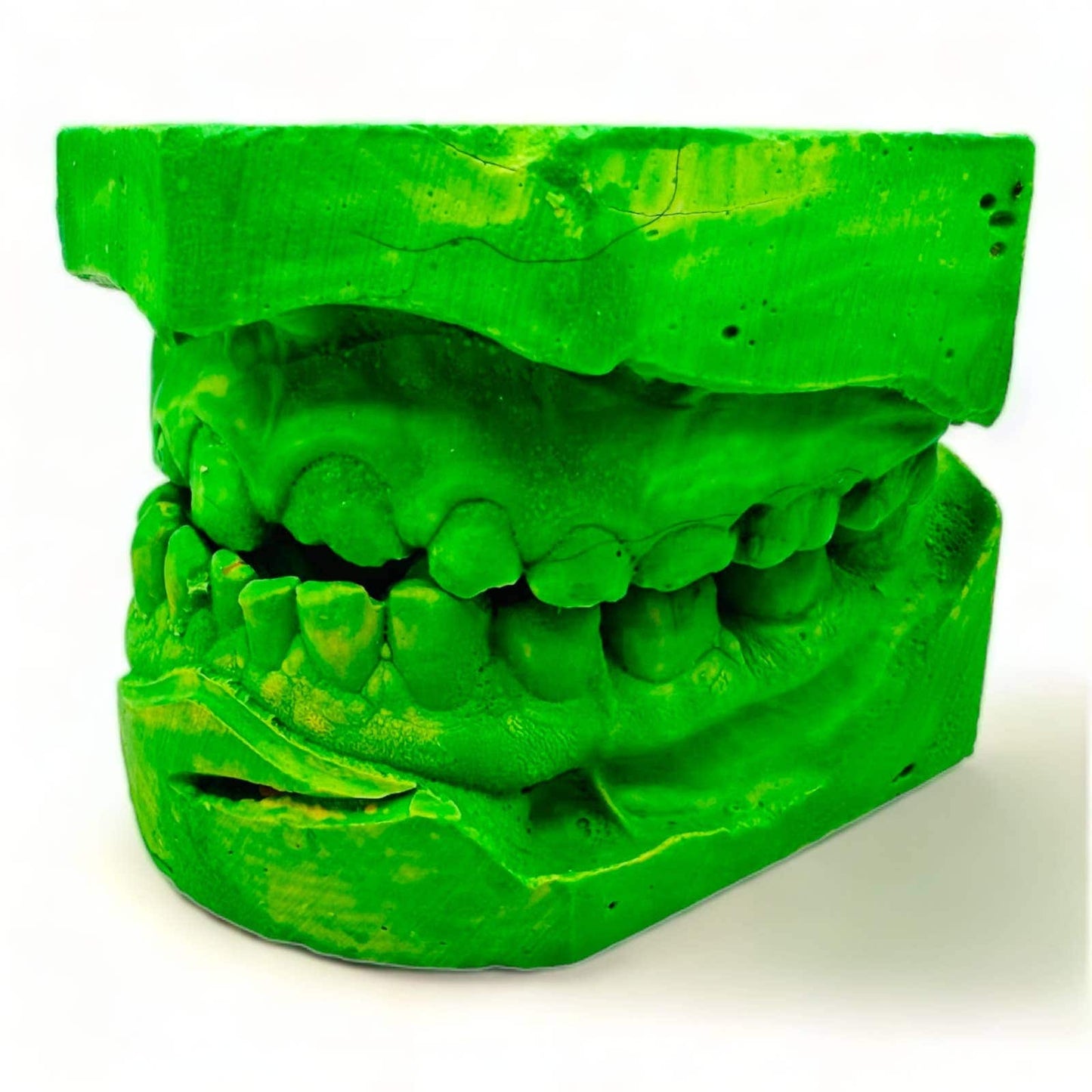 Vintage Dental Molds - Oddity - Teeth Moulds - Creepy Halloween