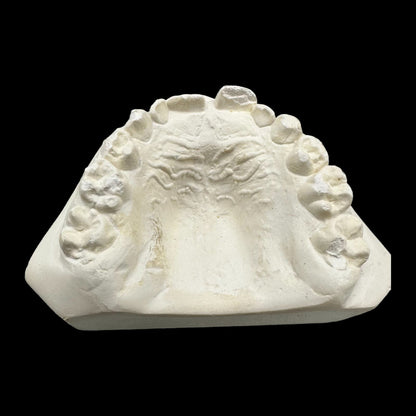 Vintage Plaster Dental Mold - Teeth Tooth Mold - Creepy Oddity - Dental Oddities!