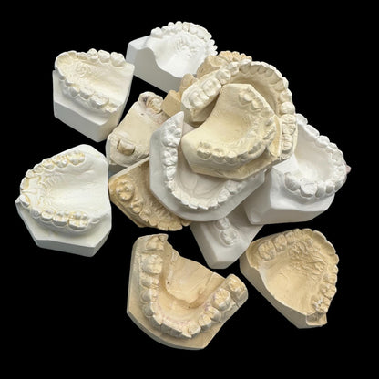 Vintage Plaster Dental Mold - Teeth Tooth Mold - Creepy Oddity - Dental Oddities!