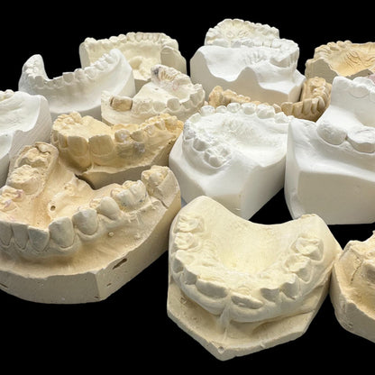 Vintage Plaster Dental Mold - Teeth Tooth Mold - Creepy Oddity - Dental Oddities!