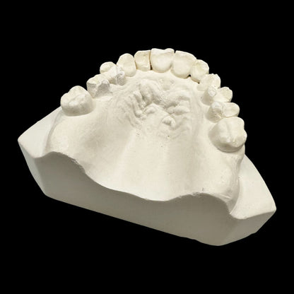 Vintage Plaster Dental Mold - Teeth Tooth Mold - Creepy Oddity - Dental Oddities!