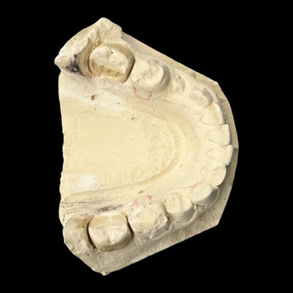 LOT of 10 Vintage Plaster Dental Mold, Teeth Tooth Mold - Creepy Oddity Oddities